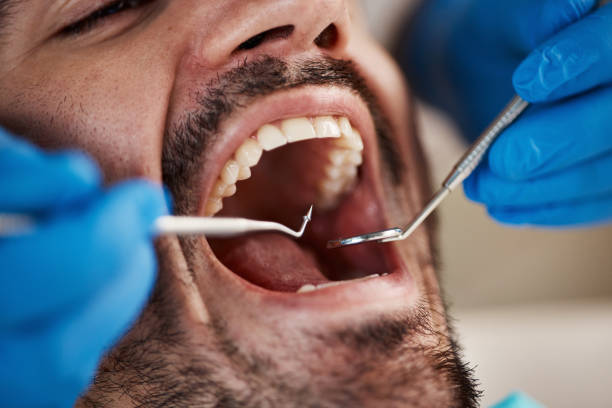 Best Emergency Dental Care for Broken or Chipped Teeth in Fruit Hill, OH