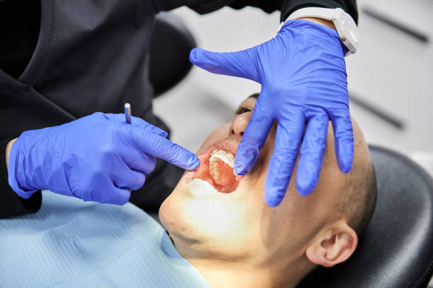 Best Emergency Dental Care for Broken or Chipped Teeth in Fruit Hill, OH